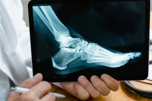 Personal injury